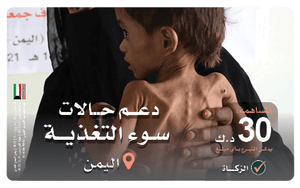 دعم حالات سوء التغذية باليمن - photo