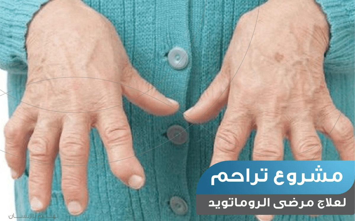 علاج مرضى الروماتويد - داخل الكويت - نماء الخيرية